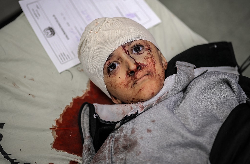 طفل يتلقى العلاج في مستشفى ناصر في خان يونس بعد إصابته في غارة إسرائيلية (تصوير: أ ف ب)