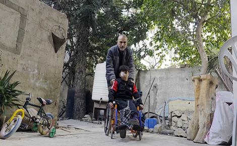 الطفل محمد فقد عائلته وإحدى عينيه ويأمل بالعلاج