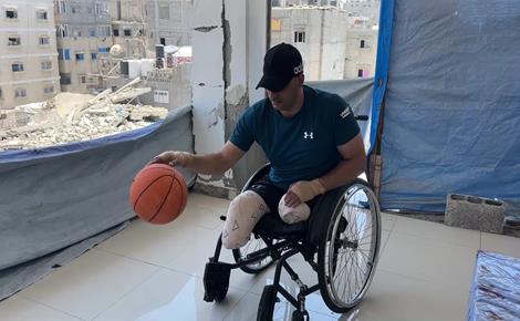 بعد بتر ساقيه.. شبير يحوّل الألم إلى أمل