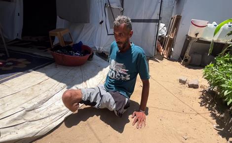 محمود بطالب بحقه في المشي بعد بتر ساقيه