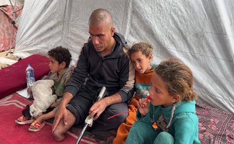 الاحتلال يحرم محمود الزربة من بصره وساقه 