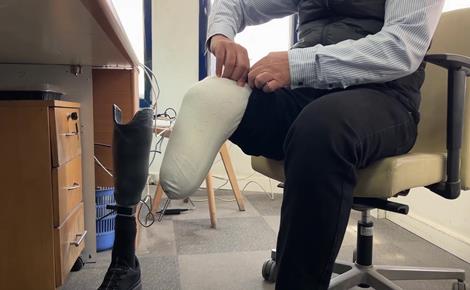 الزعيم يعود لعمله بساق واحدة 