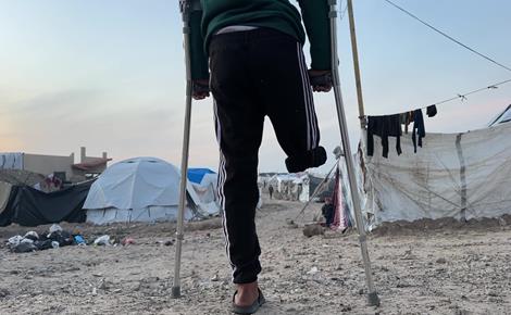 طفل من غزة يواظب على زيارة مكان دفن ساقه المبتورة 