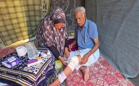 نار الاحتلال تهدّد حياة النازحين جنوب قطاع غزة